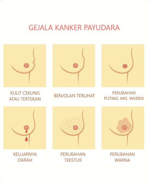 A prudent approach involves seeking medical attention promptly upon discovering a new lump in the breast. Professional evaluation is essential to determine the nature of the lump and guide appropriate next steps. Know more about their business, visit the website https://melaniebreastspecialist.com/id/tentang-payudara-kondisi/saya-memiliki-benjolan-payudara-itu-kanker/